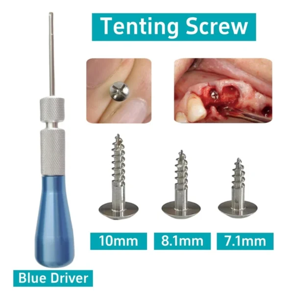1Set Tenting Screws